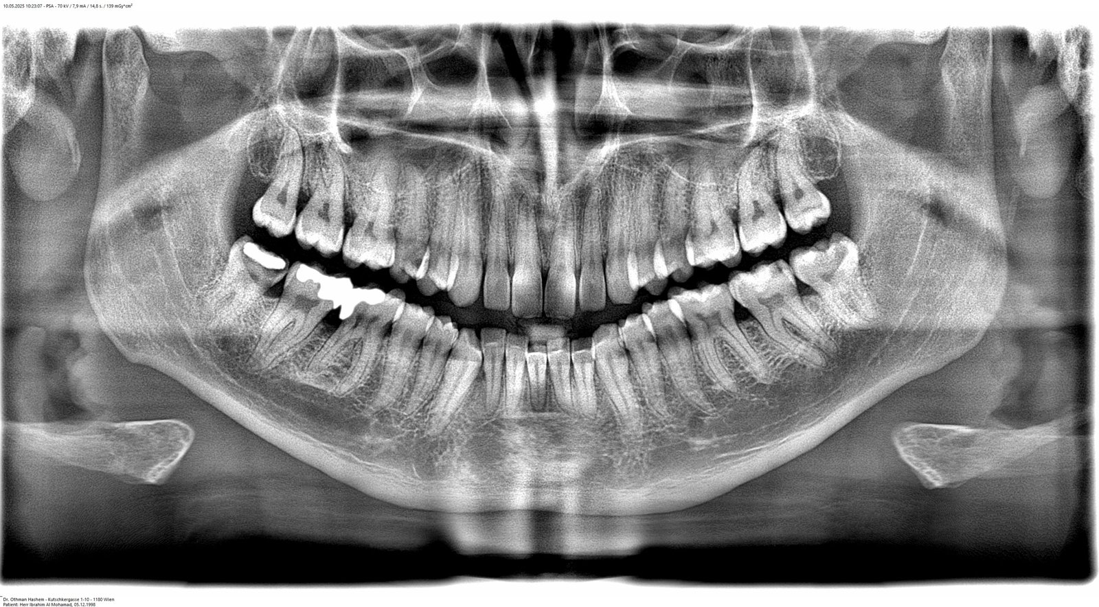 DVT Gerät Detailansicht