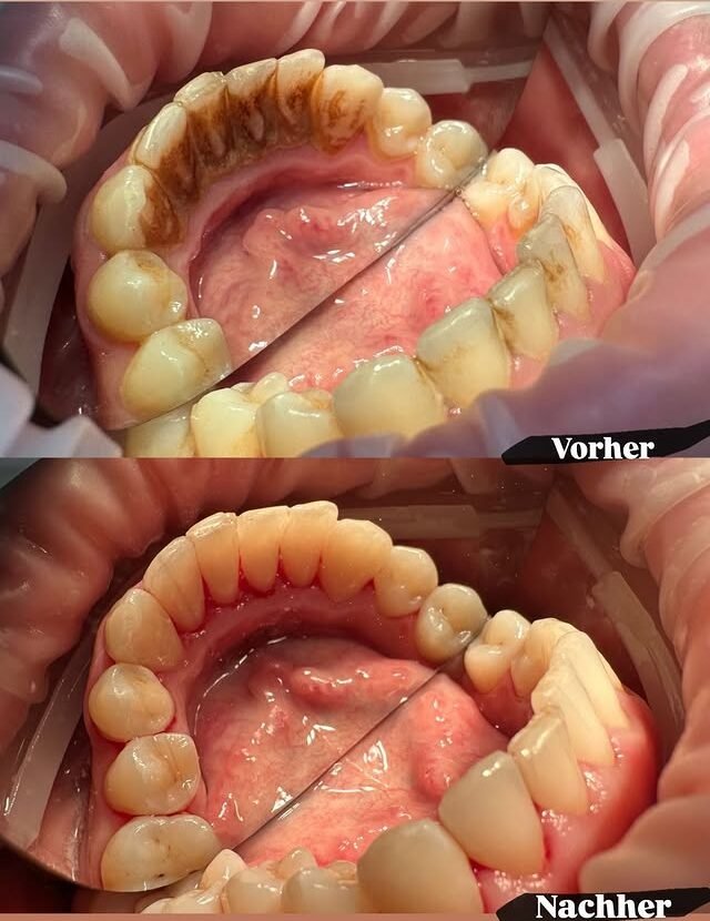 Individuelle Beratung