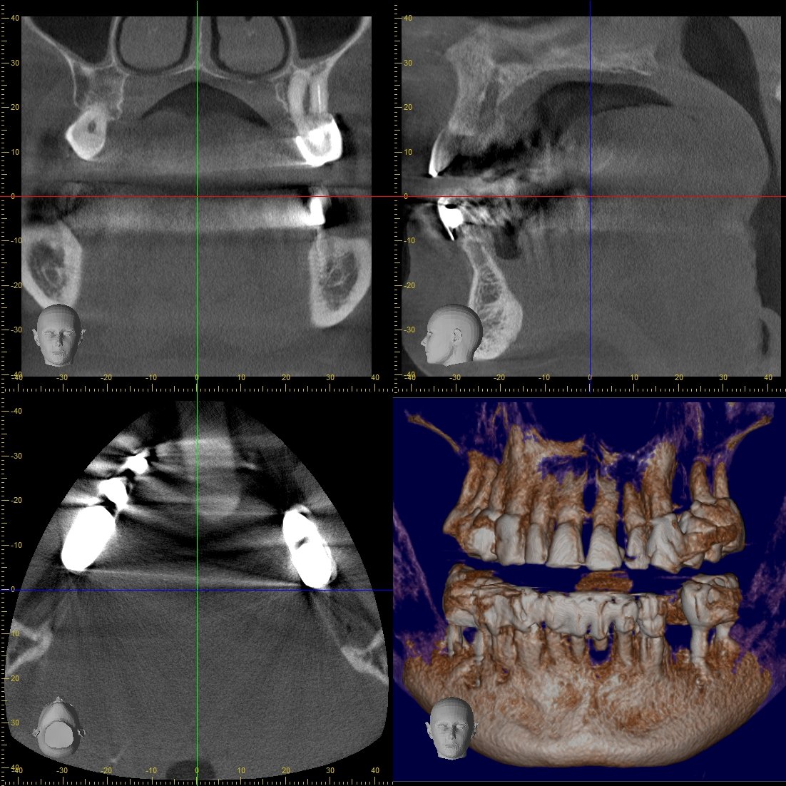 DVT Gerät Detailansicht